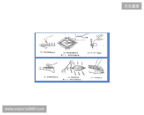 广州豹官方：杨浩眉弓伤口缝合30余针，预计5-7天后拆线